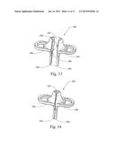 DEVICE, KIT AND METHOD FOR PLACING JEJUNAL TUBE DEVICE THROUGH STOMACH AND     INTO SMALL INTESTINE RELATED APPLICATION diagram and image