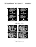 Anti-Cancer Agent diagram and image