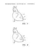 ECM Constructs for Treating Damaged Biological Tissue diagram and image