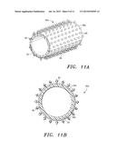 ECM Constructs for Treating Damaged Biological Tissue diagram and image