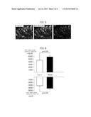 PLURIPOTENT STEM CELL THAT INDUCES REPAIR AND REGENERATION AFTER     MYOCARDIAL INFARCTION diagram and image