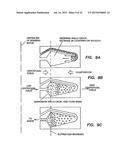 METHODS OF USING REGENERATIVE CELLS IN THE TREATMENT OF PERIPHERAL     VASCULAR DISEASE AND RELATED DISORDERS diagram and image