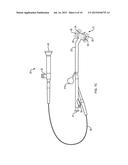 INTERVENTIONAL SINUS ENDOSCOPE diagram and image