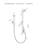 INTERVENTIONAL SINUS ENDOSCOPE diagram and image