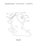 MAGNETIC STIMULATION COILS AND FERROMAGNETIC COMPONENTS FOR REDUCED     SURFACE STIMULATION AND IMPROVED TREATMENT DEPTH diagram and image