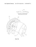 MAGNETIC STIMULATION COILS AND FERROMAGNETIC COMPONENTS FOR REDUCED     SURFACE STIMULATION AND IMPROVED TREATMENT DEPTH diagram and image