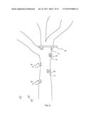 System for Removably Mounting Proprietary Equipment in a Tree Stand diagram and image