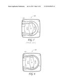 HIGH PRESSURE, HIGH FLOW RATE PERISTALTIC PUMP AND TUBING ASSEMBLY diagram and image