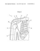 ANATOMICAL MODEL FOR TRAINING AID FOR LEARNING REDUCTIONTECHNIQUES AND A     METHOD FOR LEARNING THE REDUCTION TECHNIQUESUSING THE ANATOMICAL MODEL     FOR TRAINING AID diagram and image