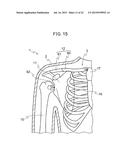 ANATOMICAL MODEL FOR TRAINING AID FOR LEARNING REDUCTIONTECHNIQUES AND A     METHOD FOR LEARNING THE REDUCTION TECHNIQUESUSING THE ANATOMICAL MODEL     FOR TRAINING AID diagram and image