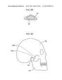 ANATOMICAL MODEL FOR TRAINING AID FOR LEARNING REDUCTIONTECHNIQUES AND A     METHOD FOR LEARNING THE REDUCTION TECHNIQUESUSING THE ANATOMICAL MODEL     FOR TRAINING AID diagram and image