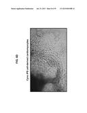 Autologous Mammalian Models Derived from Induced Pluripotent Stem Cells     and Related Methods diagram and image