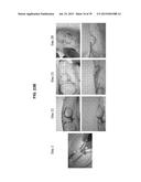 Autologous Mammalian Models Derived from Induced Pluripotent Stem Cells     and Related Methods diagram and image