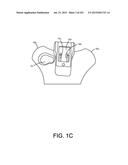 ENCASEMENTS FOR AN ELECTRONIC DEVICE HAVING A BIOMETRIC SCANNER diagram and image