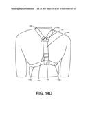 ENCASEMENTS FOR AN ELECTRONIC DEVICE HAVING A BIOMETRIC SCANNER diagram and image