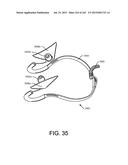 ENCASEMENTS FOR AN ELECTRONIC DEVICE HAVING A BIOMETRIC SCANNER diagram and image