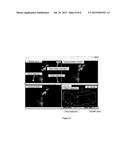 COMPUTER AIDED DIAGNOSIS FOR DETECTING ABDOMINAL BLEEDING WITH 3D     ULTRASOUND IMAGING diagram and image