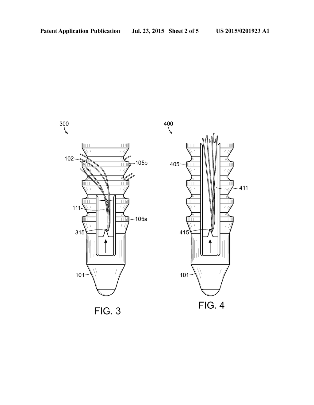 KNOTLESS ANCHOR FOR INSTABILITY REPAIR - diagram, schematic, and image 03