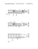 KNOTLESS ANCHOR FOR INSTABILITY REPAIR diagram and image