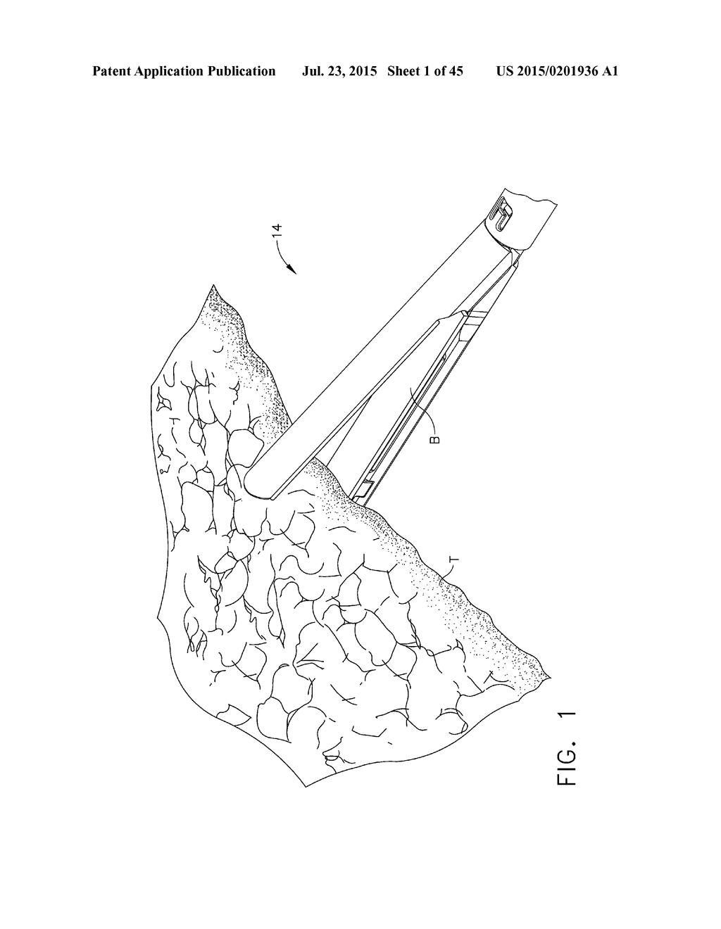 LAYER ARRANGEMENTS FOR SURGICAL STAPLE CARTRIDGES - diagram, schematic, and image 02