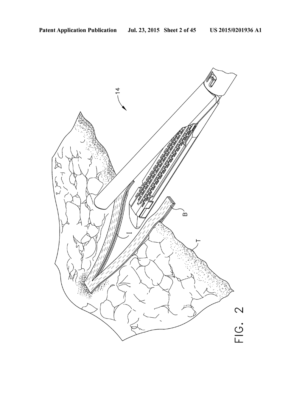 LAYER ARRANGEMENTS FOR SURGICAL STAPLE CARTRIDGES - diagram, schematic, and image 03