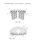 LAYER ARRANGEMENTS FOR SURGICAL STAPLE CARTRIDGES diagram and image