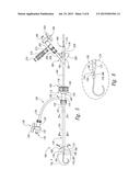 CATHETERS FOR EMERGENCY ENDOVASCULAR SURGERY AND ASSOCIATED DEVICES,     SYSTEMS, AND METHODS diagram and image