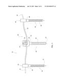 SPINAL CORRECTION SYSTEM AND METHOD diagram and image