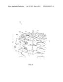 SPINAL CORRECTION SYSTEM AND METHOD diagram and image