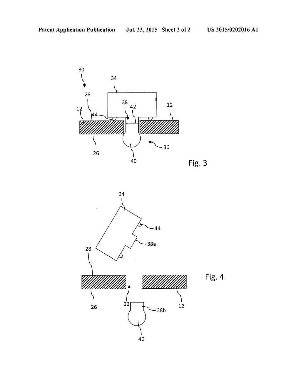 Impact-Resistant Fastening Assembly for a Medical Device - diagram, schematic, and image 03