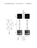 METHOD FOR PROCESSING IMAGES OF INTERVENTIONAL RADIOLOGY diagram and image