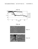 METHOD FOR PROCESSING IMAGES OF INTERVENTIONAL RADIOLOGY diagram and image