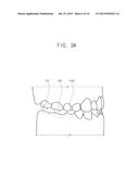 BONE PEN, BONE PIN, BONE PEN SET, BONE PIN SET AND BONE PEN KIT INCLUDING     THE SAME AND INITIAL DRILL diagram and image