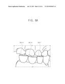 BONE PEN, BONE PIN, BONE PEN SET, BONE PIN SET AND BONE PEN KIT INCLUDING     THE SAME AND INITIAL DRILL diagram and image