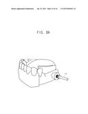 BONE PEN, BONE PIN, BONE PEN SET, BONE PIN SET AND BONE PEN KIT INCLUDING     THE SAME AND INITIAL DRILL diagram and image