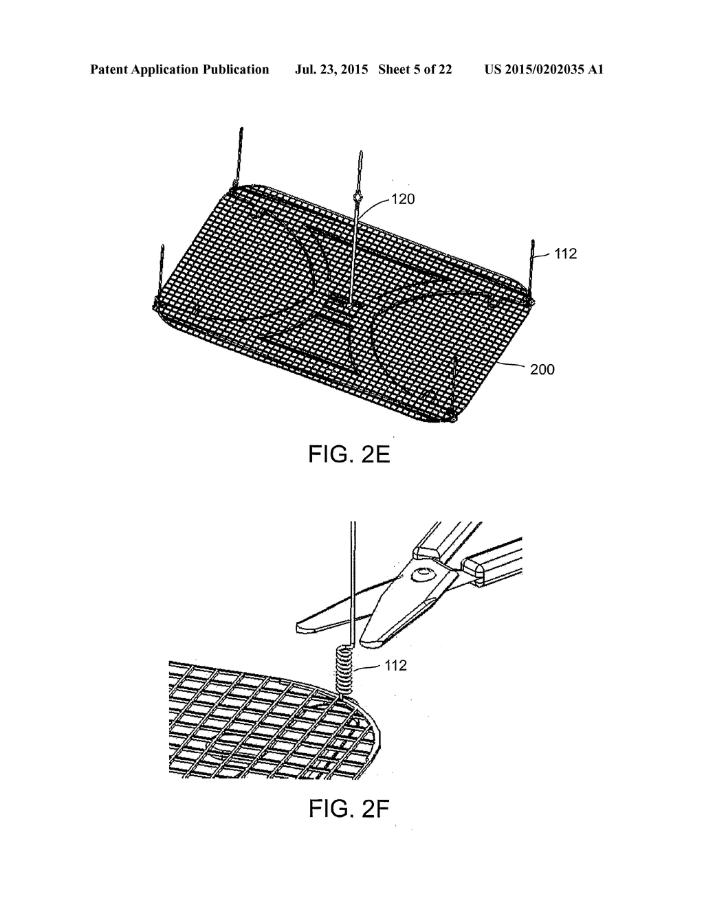 METHOD AND APPARATUS FOR REPAIRING A HERNIA - diagram, schematic, and image 06