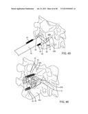 SPINAL FUSION SYSTEM diagram and image