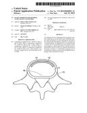 IN-SITU FORMED INTERVERTEBRAL FUSION DEVICE AND METHOD diagram and image