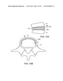 IN-SITU FORMED INTERVERTEBRAL FUSION DEVICE AND METHOD diagram and image