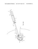 INSERTION HANDLE FOR SURGICAL IMPLANTS diagram and image