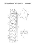 Sheath Capture Device For Stent Graft Delivery System And Method For     Operating Same diagram and image