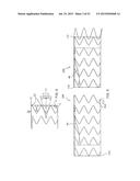 Sheath Capture Device For Stent Graft Delivery System And Method For     Operating Same diagram and image