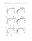 Sheath Capture Device For Stent Graft Delivery System And Method For     Operating Same diagram and image