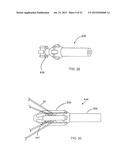 Sheath Capture Device For Stent Graft Delivery System And Method For     Operating Same diagram and image