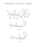 Sheath Capture Device For Stent Graft Delivery System And Method For     Operating Same diagram and image