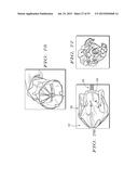 Sheath Capture Device For Stent Graft Delivery System And Method For     Operating Same diagram and image