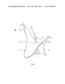 Absorbent Article diagram and image