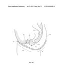 Absorbent Article diagram and image