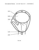 Absorbent Article diagram and image