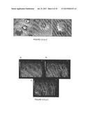 LIPOSOMAL DRUG DELIVERY SYSTEM diagram and image